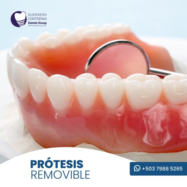 protesis.jpg