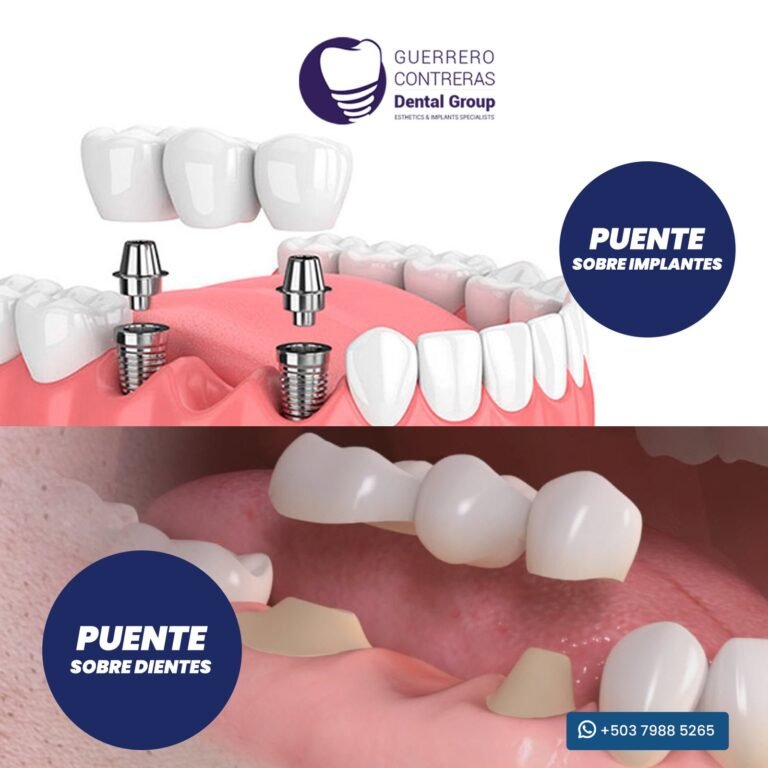 puentes.jpg